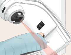 健康科普 | 說說放療那點事兒